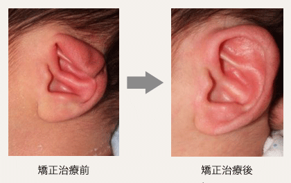 折れ耳の画像