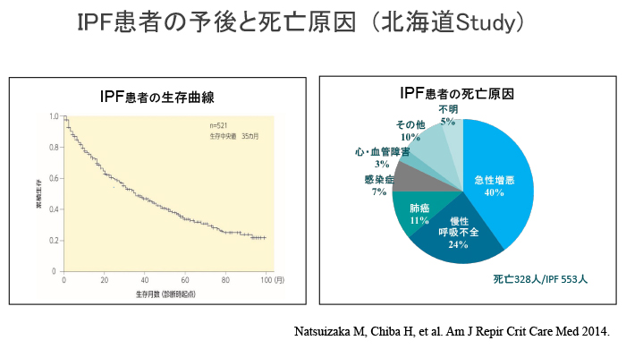 IPF患者の予後と死亡原因 (北海道Study)