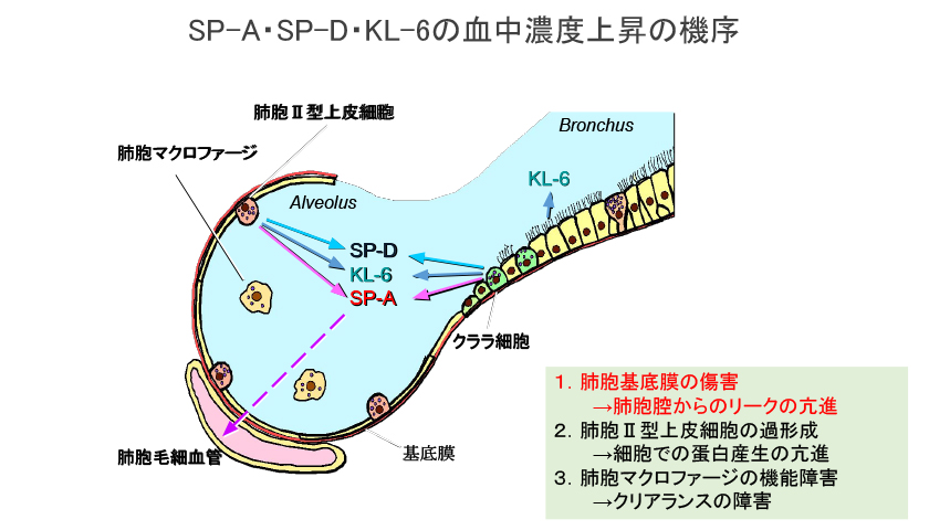 SP-A・SP-D・KL-6の血中濃度上場の機序