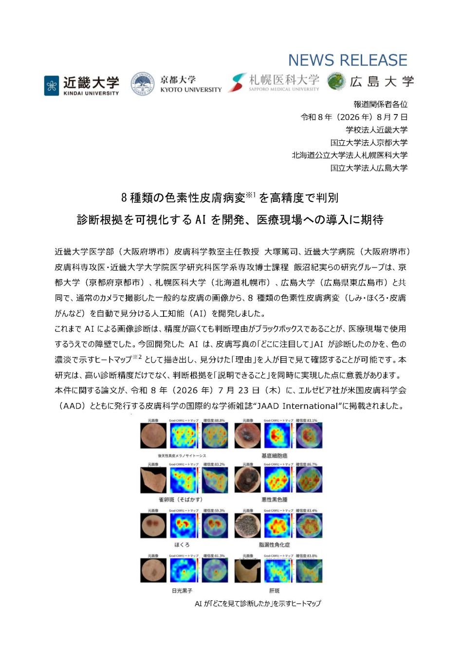 8種類の色素性皮膚病変を高精度で判別