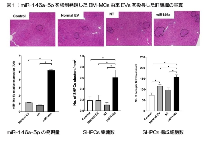 図1：miR-146a-5pを強制発現したBM-MCs由来EVsを投与した肝組織の写真