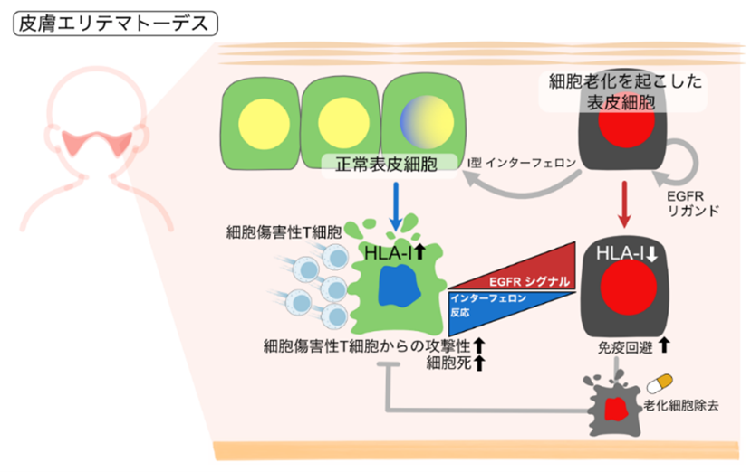 老化細胞はI型インターフェロンを産生して、正常細胞の HLA-Iの発現を高め、細胞傷害性T細胞の攻撃性を高める。