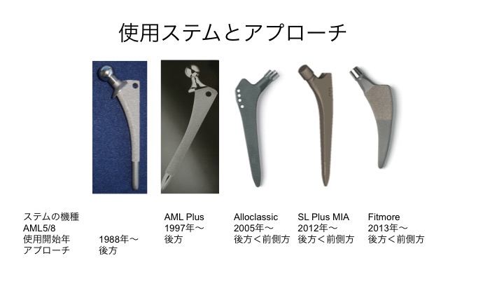 ステムとアプローチの変遷