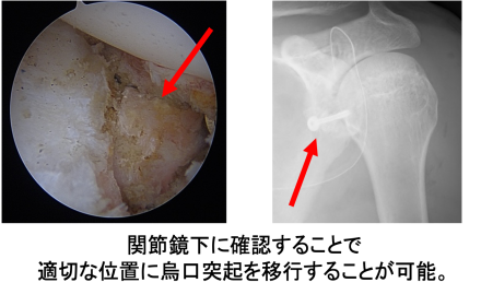 脱臼