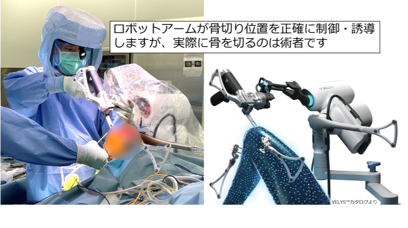 TKA2