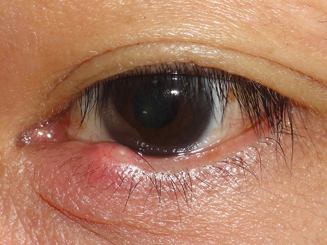 市販のまぶたスクラブの使い方