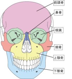 顔面骨骨折の画像