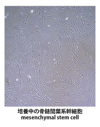 培養中の骨髄間葉系幹細胞 mesenchymal stem cell