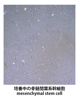 培養中の骨髄間葉系幹細胞
mesenchymal stem cell